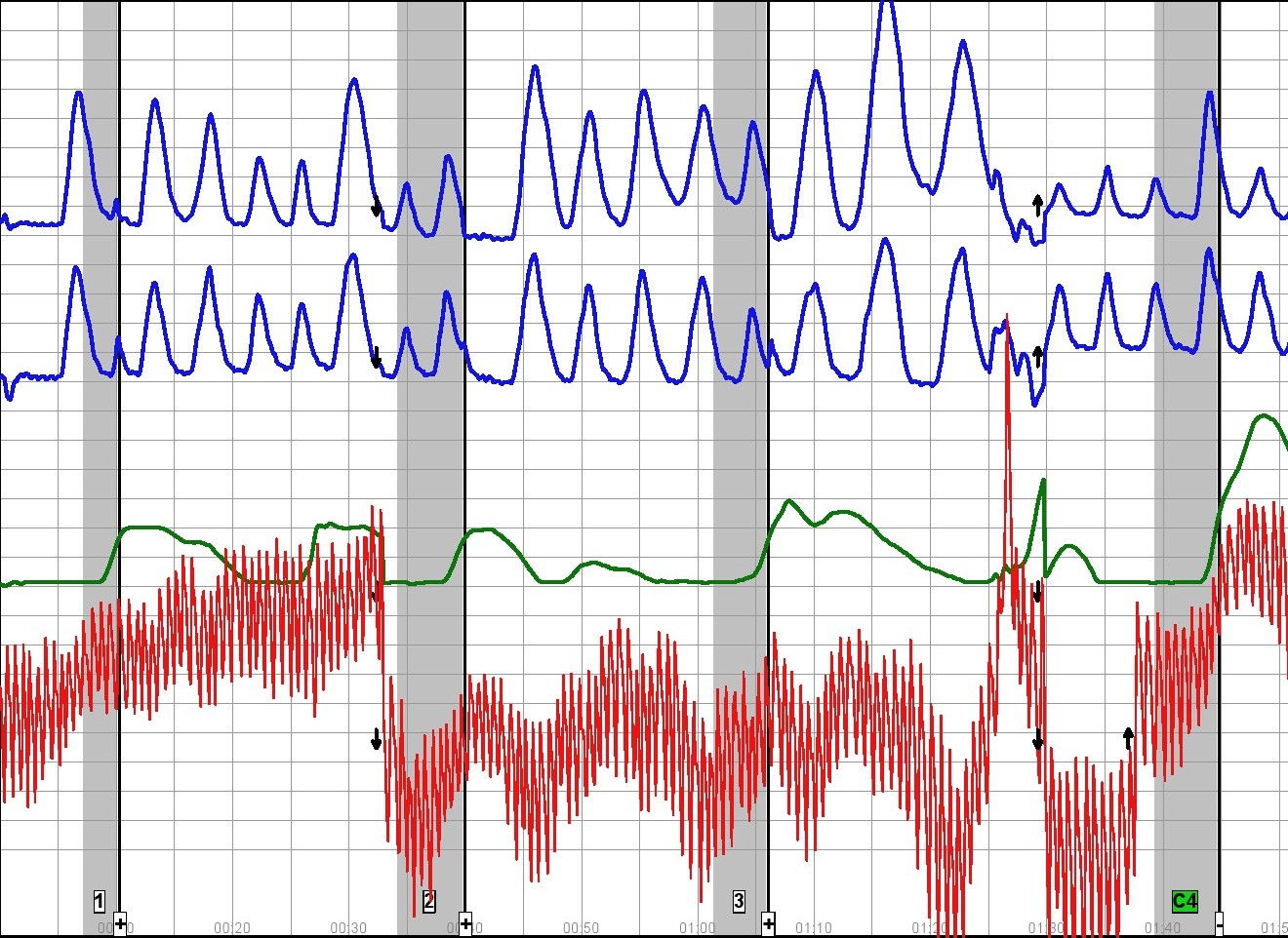 home polygraph charts
