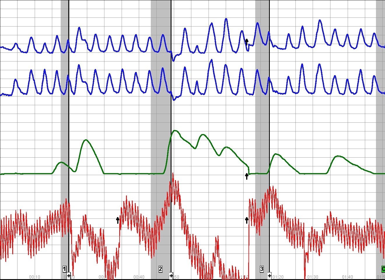 home polygraph charts