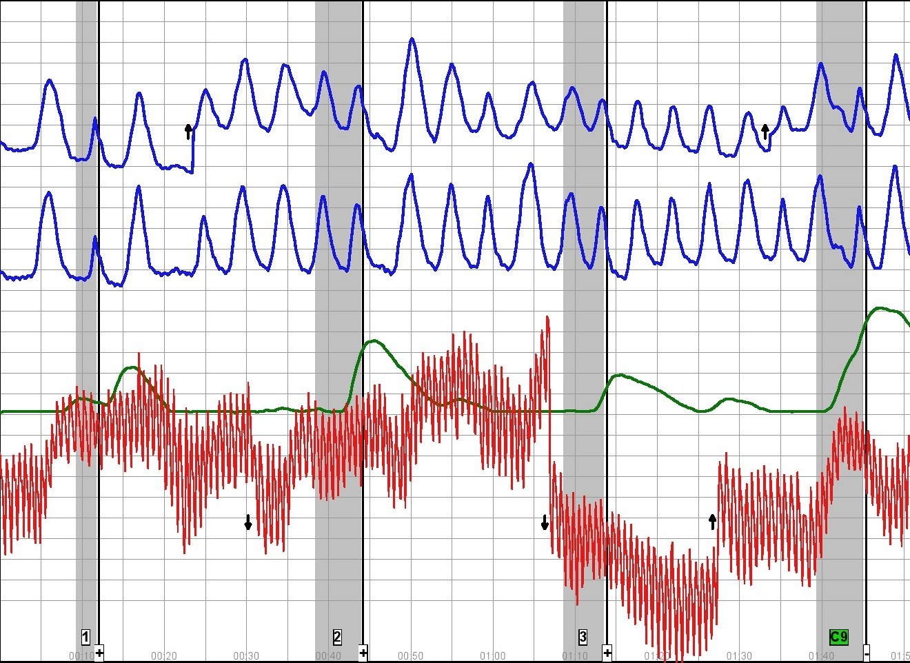 home polygraph charts